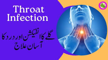 Throat Infection Ka 5 Din Ka Ilaj