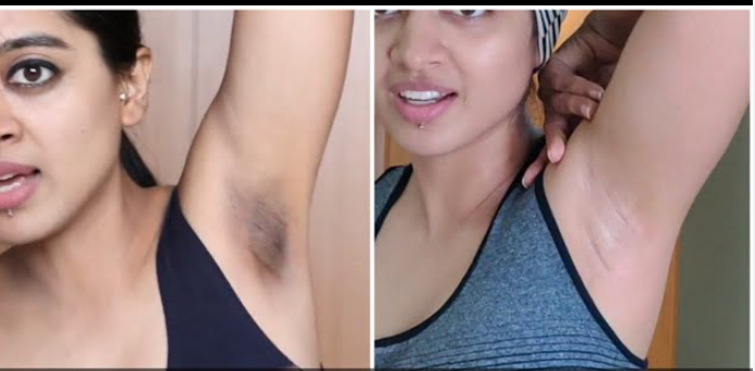 Dark Underarms Lightening Routine | 7 Days Whitening Plan