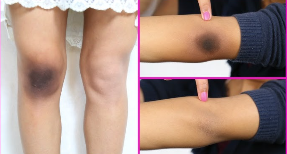 Elbow & Knee Whitening Guide